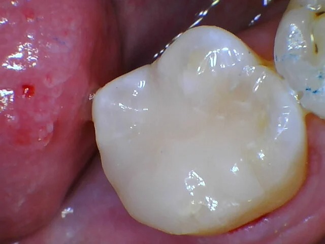 imgi_29_1474213