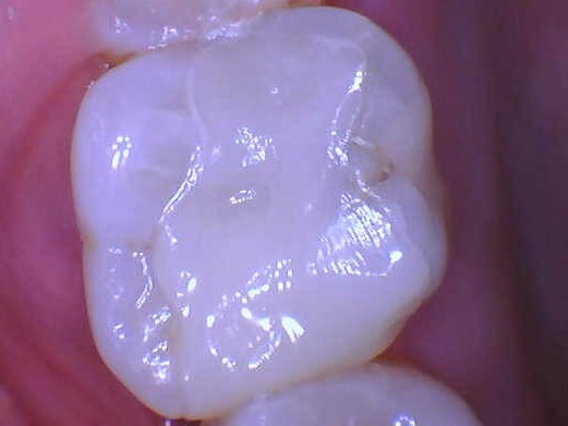 imgi_43_1558115
