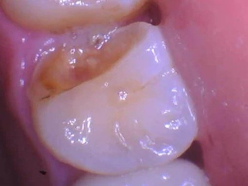 imgi_44_1550900